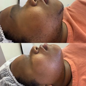 Soft Skin - Face Wax - Waxing Near Me - Southfield, Michigan Soft Skin - Face Wax - Waxing Near Me - Southfield, Michigan