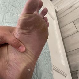 My feet after they came and "cleaned". My feet after they came and "cleaned".