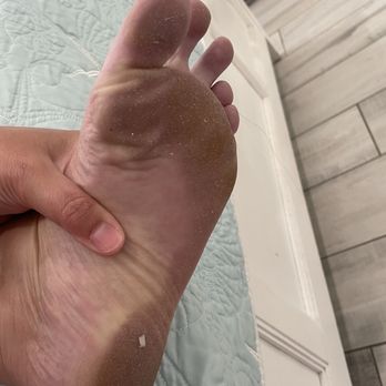 AMI Locals - My feet after they came and "cleaned". - Property Management Near Me - Anna Maria, Florida AMI Locals - My feet after they came and "cleaned". - Property Management Near Me - Anna Maria, Florida