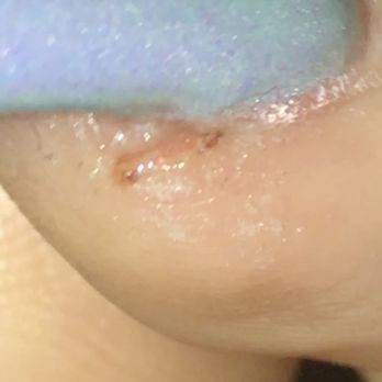 Fancy Nails - Got infected. - Nail Salons Near Me - Irving, Texas Fancy Nails - Got infected. - Nail Salons Near Me - Irving, Texas