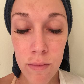 Rachael Ostrea, LE - Before - Permanent Makeup Near Me - Marina del Rey, California Rachael Ostrea, LE - Before - Permanent Makeup Near Me - Marina del Rey, California