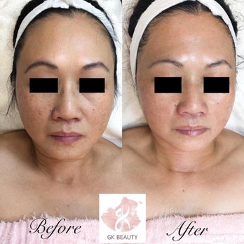 GK Beauty - Brightening facial with led light therapy, nourishing mask & eye and lip treatments. Book your appointment now! - Skin Care Near Me - Chandler, Arizona GK Beauty - Brightening facial with led light therapy, nourishing mask & eye and lip treatments. Book your appointment now! - Skin Care Near Me - Chandler, Arizona