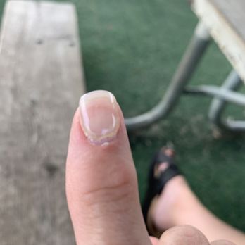 Hot Nails - This is after 2 days!!!! - Nail Salons Near Me - Osseo, Minnesota