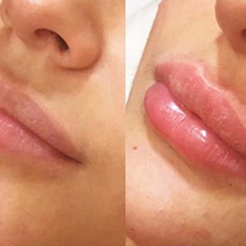 Radiant Med Spa - Laser Hair Removal Near Me - Fremont, California Radiant Med Spa - Laser Hair Removal Near Me - Fremont, California