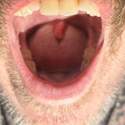 Your Total Dental & Orthodontics - Manor - This is how swollen they caused it to be and claim that these things just happen.