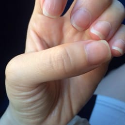 They gave me huge, deep scratches across my nails (1/2)
