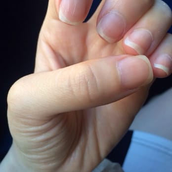 Blush Nail Spa - They gave me huge, deep scratches across my nails (1/2) - Nail Salons Near Me - Madison, Wisconsin