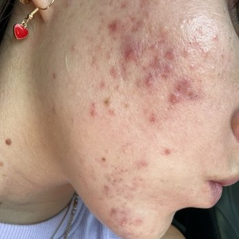 Bespoke Dermatology & Aesthetics - Dermatologists Near Me - Arcadia, California Bespoke Dermatology & Aesthetics - Dermatologists Near Me - Arcadia, California