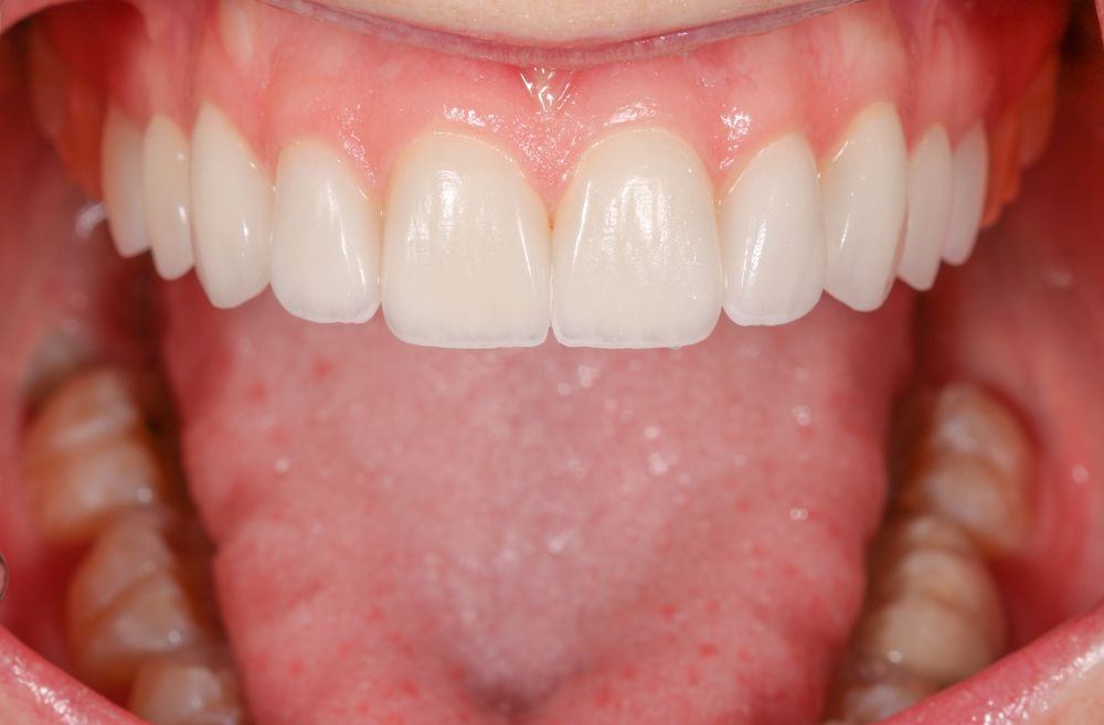 Chicago Center for Advanced Dentistry