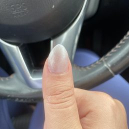 Horrible shape