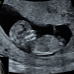 Life in Bloom Sonography Studio 3D/4D Ultrasound Lincoln, NE