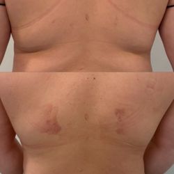 Biolift Med Spa - Cryo
