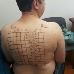 John Kellogg, MD, MS - Allergy test..p.s. yes I need to lose weight.