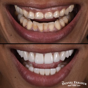 The Dental Parlour - General Dentistry Near Me - New York, New York The Dental Parlour - General Dentistry Near Me - New York, New York