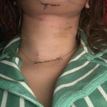 Athré Facial Plastics - Another scar on my face. - Cosmetic Surgeons Near Me - Houston, Texas Athré Facial Plastics - Another scar on my face. - Cosmetic Surgeons Near Me - Houston, Texas