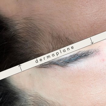 Skin By Rachel Amar - Dermaplane results - Hair Removal Near Me Skin By Rachel Amar - Dermaplane results - Hair Removal Near Me