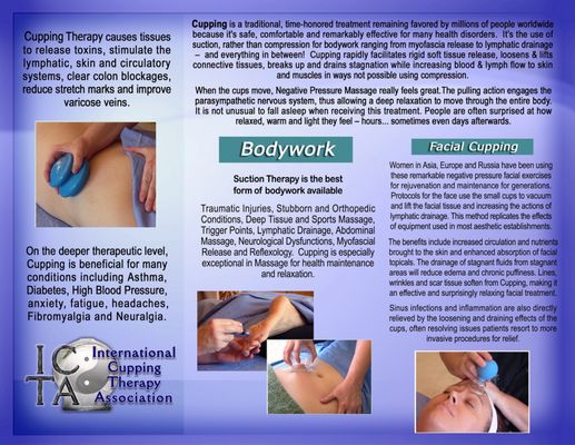 Hijama Cupping Therapy
