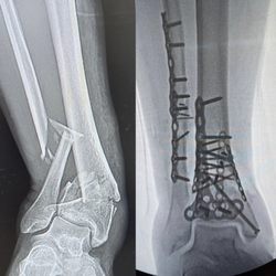 Aziz Rasooli, DPM- Memorial Orthopaedic Surgical Group