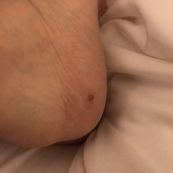 My i Nails - Scraped raw on my heel - Nail Salons Near Me - Glendale, Arizona