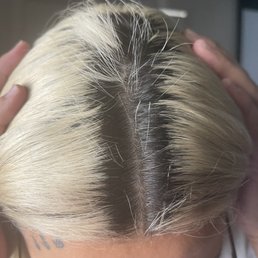 Damage is towards the back of the head and very short but growing Damage is towards the back of the head and very short but growing