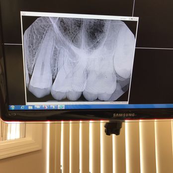 Zahra Hosseini, DMD - My wisdom tooth says hi - General Dentistry Near Me - Hackensack, New Jersey Zahra Hosseini, DMD - My wisdom tooth says hi - General Dentistry Near Me - Hackensack, New Jersey