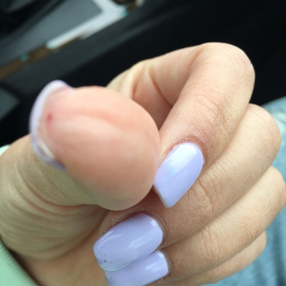 Foxy Nails - knicked thumb, wouldn't of hurt so bad if I also hadn't been insulted - Nail Salons Near Me - Boise, Idaho Foxy Nails - knicked thumb, wouldn't of hurt so bad if I also hadn't been insulted - Nail Salons Near Me - Boise, Idaho