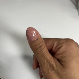 Right thumb nicked Right thumb nicked