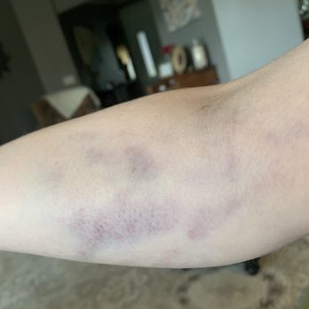 Biolife Plasma Services 34 Photos 132 Reviews Blood Plasma Donation Centers 14415 Owen Tech Blvd Austin Tx Phone Number