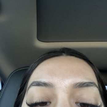 First Class Esthetics Lounge - Here you can also tell my left one is just a complete different shape than my right. This was after I went back for her to "fix" them. - Skin Care Near Me - Los Angeles, California