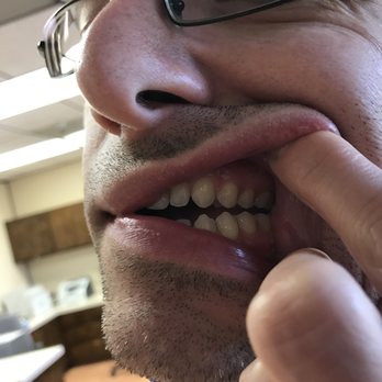 Eyvazi Dental - Erik Pic 4 (after) - Orthodontists Near Me - Hawthorne, California Eyvazi Dental - Erik Pic 4 (after) - Orthodontists Near Me - Hawthorne, California