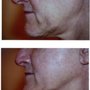 Photo of All About Skin Laser Center