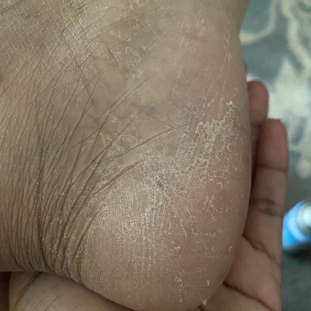 Lucy Nails & Spa - This is soon as I got home I still need a pedicure one of the main parts of a pedicure is the foot scrubbing - Nail Salons Near Me - Chico, California