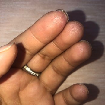 Queen Nails - My finger tips peeling after getting a full set and them breaking all off after a week! - Nail Salons Near Me - Bellflower, California Queen Nails - My finger tips peeling after getting a full set and them breaking all off after a week! - Nail Salons Near Me - Bellflower, California
