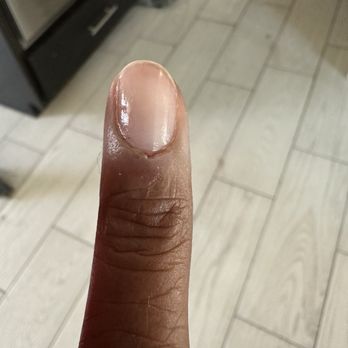 Zara Nail Lounge - The bleeding stopped but you can see where I was nicked. - Nail Salons Near Me - El Paso, Texas Zara Nail Lounge - The bleeding stopped but you can see where I was nicked. - Nail Salons Near Me - El Paso, Texas