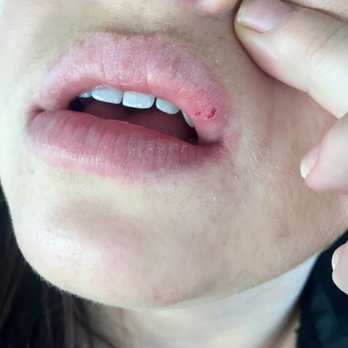 Galdiano Dentistry - Courtesy of the careless assistant - General Dentistry Near Me - Oceanside, California