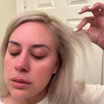 Gloss Hair Studio - More breakage along hairline. Underneath the part I'm holding is basically a bald spot. Burned off. Excuse my red face, I was crying - Hair Salons Near Me - San Diego, California