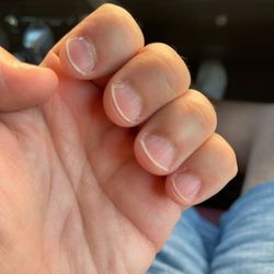 Precious 1 Nail - This was right out of the 'spa'. All my cuticles...