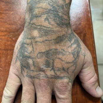 Way Gone Laser Tattoo Removal - Tattoo - Tattoo Removal Near Me - Honolulu, Hawaii Way Gone Laser Tattoo Removal - Tattoo - Tattoo Removal Near Me - Honolulu, Hawaii