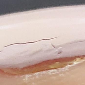 Nini Nails and Spa - Cracked, not spread to edges, on first day after nails dried - Nail Salons Near Me - Orlando, Florida Nini Nails and Spa - Cracked, not spread to edges, on first day after nails dried - Nail Salons Near Me - Orlando, Florida