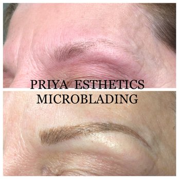 Priya Esthetics - Skin Care Near Me - Herndon, Virginia
