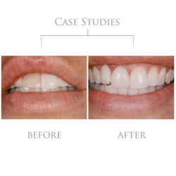 Michael R. Herman DDS, PHD, FAGD, DAAPM, FIADFE
