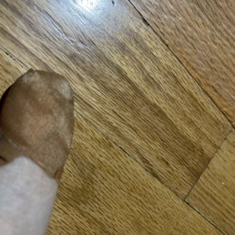 My big toe wrapped in large Band-Aids. I will update it with pictures as it heals.