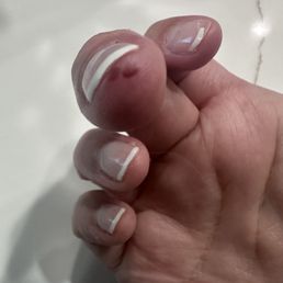 The spider bite