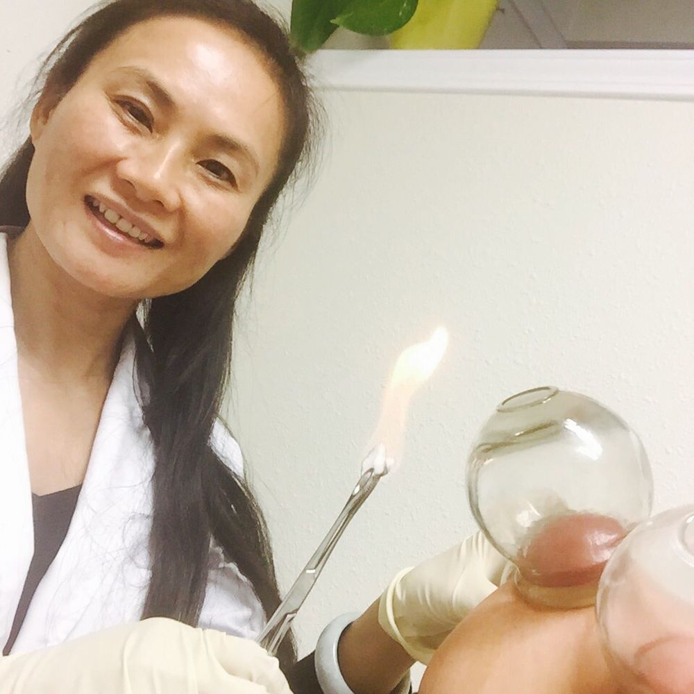 United University Clinic - Acupuncture Near Me - Chino, California