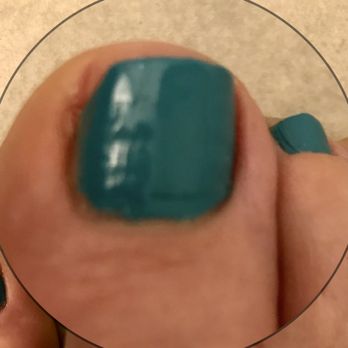 Nails 2 - Nail edge cut improperly which exposed the skin normally covered by my nail. - Nail Salons Near Me - Boca Raton, Florida Nails 2 - Nail edge cut improperly which exposed the skin normally covered by my nail. - Nail Salons Near Me - Boca Raton, Florida