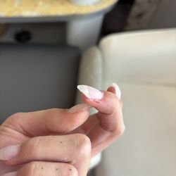 Noire Nail Bar - The cut on my finger from her filing my nails very carelessly, it was bleeding before this.