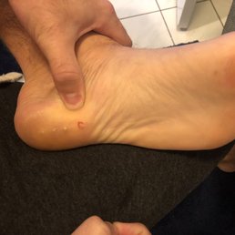 My foot after walking on nails.