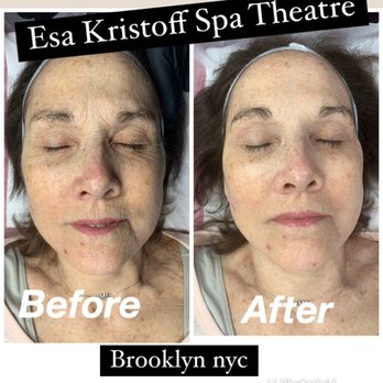 Esa Kristoff Spa Theatre - Skin Care Near Me - Brooklyn, New York Esa Kristoff Spa Theatre - Skin Care Near Me - Brooklyn, New York