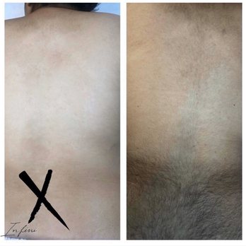 Infini X - Back wax - Eyelash Service Near Me - Southfield, Michigan Infini X - Back wax - Eyelash Service Near Me - Southfield, Michigan