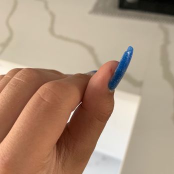 Champagne Nail Spa - A cut on my thumb - Nail Salons Near Me - Hialeah, Florida